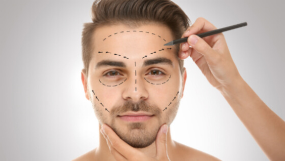 modelo masculino com demarcação no rosto de rinoplastia masculina