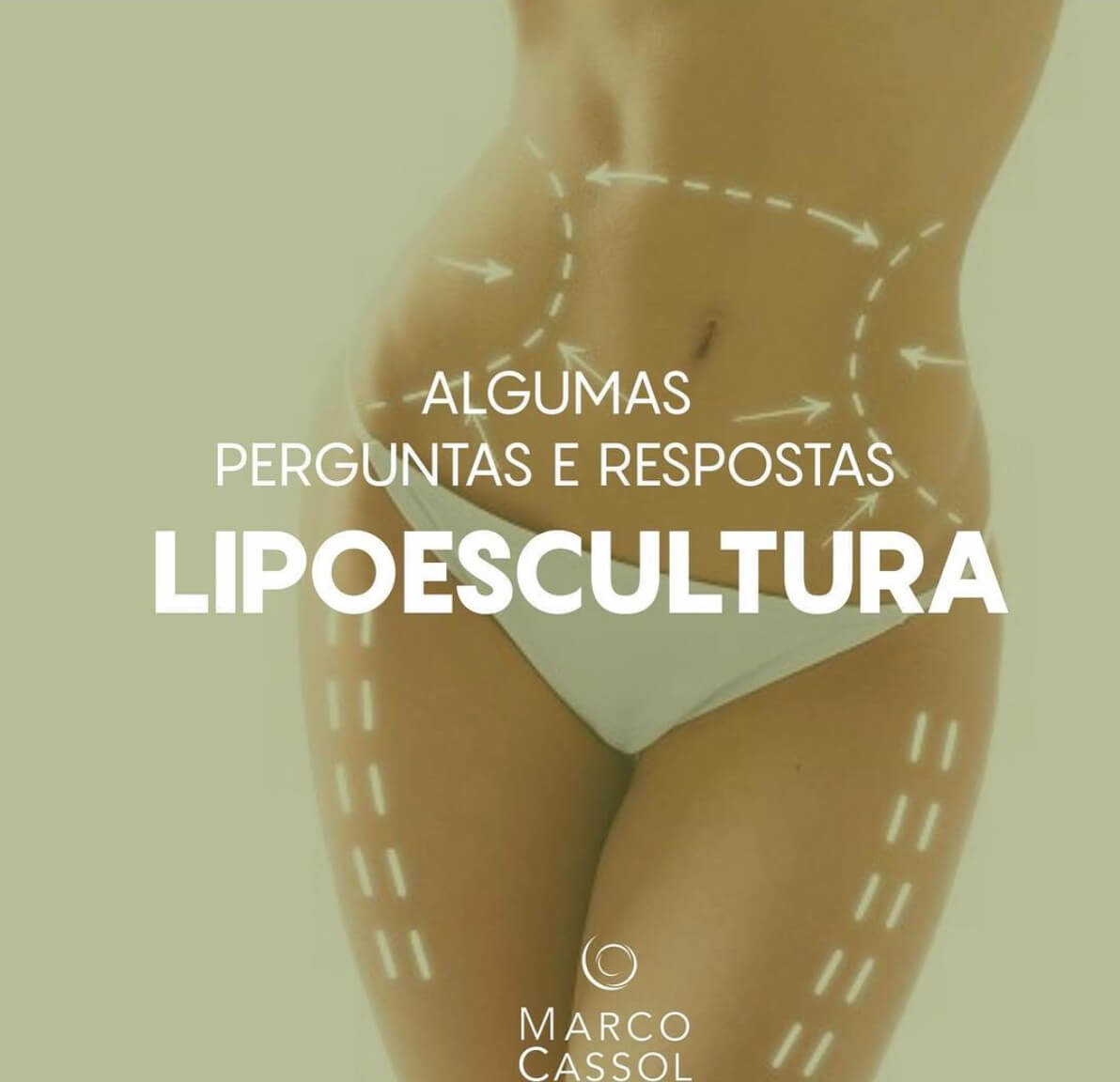 lipoaspiração