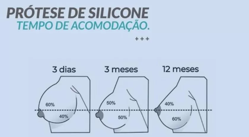 acomodacao das proteges de silicone