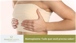 imagem destacada do post tudo sobre mamoplastia