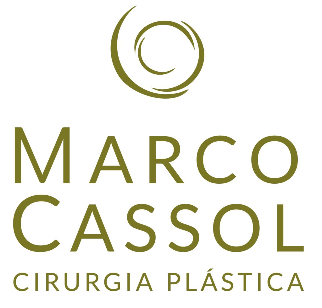 antes e depois da lipoaspiração - Dr. Marco Cassol