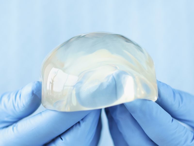 prótese de silicone virada - implante mamário