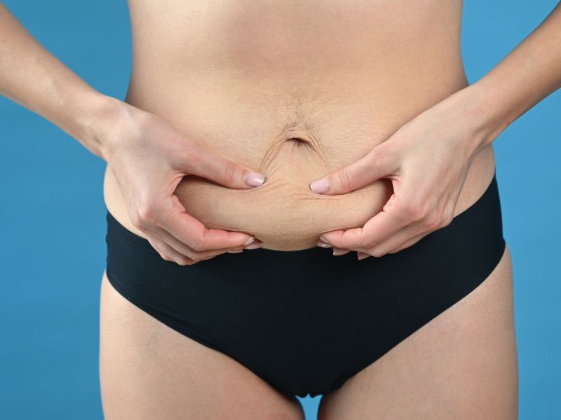mommy makeover antes e depois - corpo
